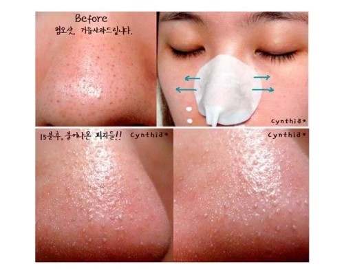 Салфетки для удаления черных точек Ciracle Blackhead Off Sheet